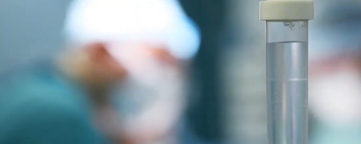 Fissatore esterno calcagno