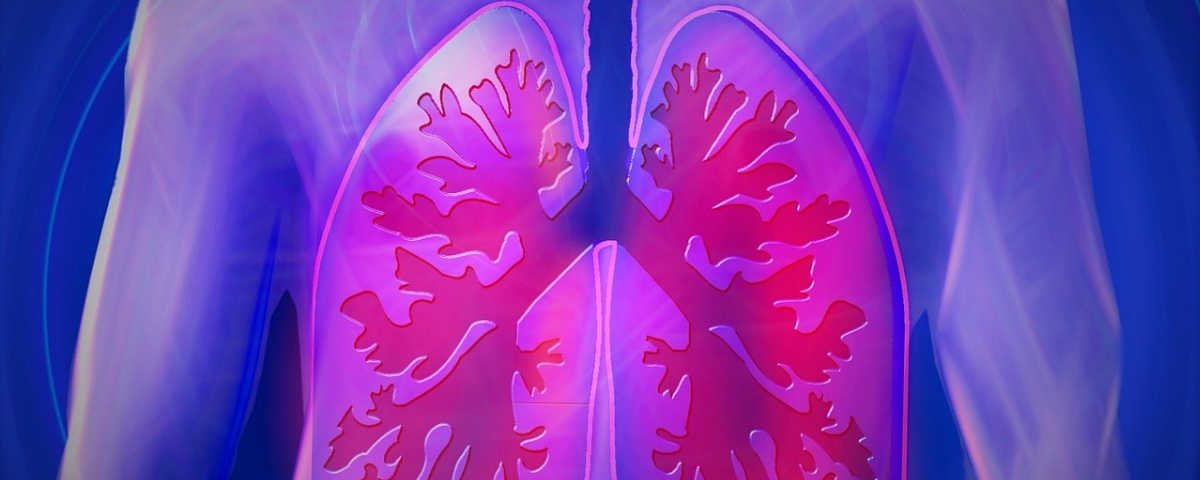 Tubercolosi multiresistente ai farmaci